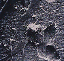 Electron micrograph slide of osteoclast leaving hole in bone