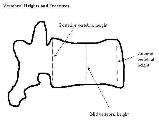 Vertebral Heights & Fractures