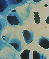 Slide of Trabecular Bone